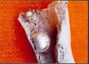 人死后需要火化吗?