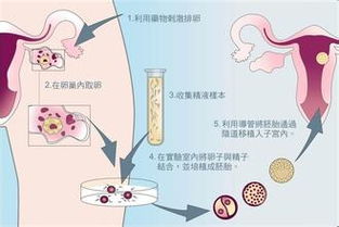 体外受精是一种特殊的生育方式,可以帮助不孕夫妇实现他们不能生
