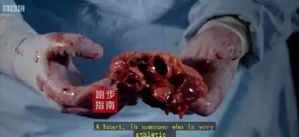 女子死于车祸,复活这样意外死亡的人在我国也有复活案例