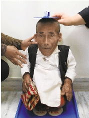 世界上最矮的人 世界上最矮的人是哪个国家